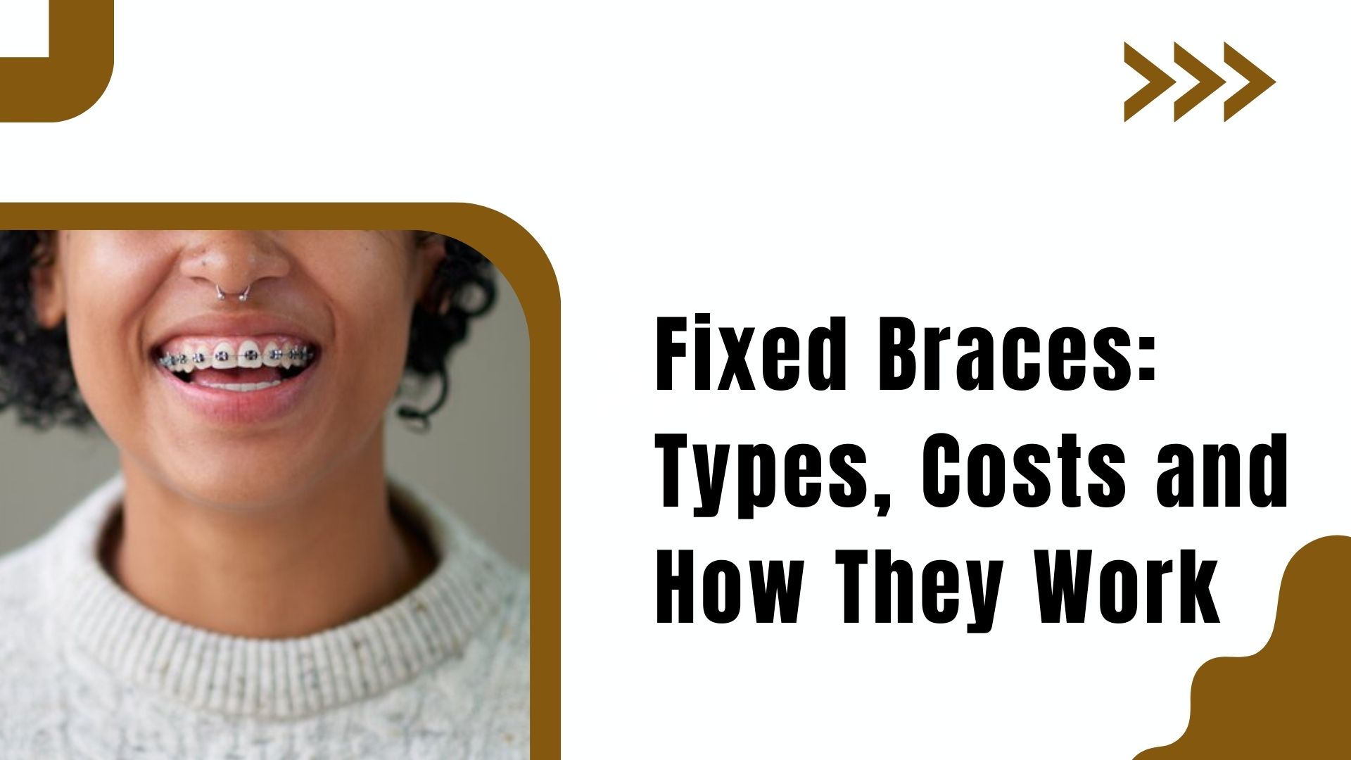 Fixed Braces